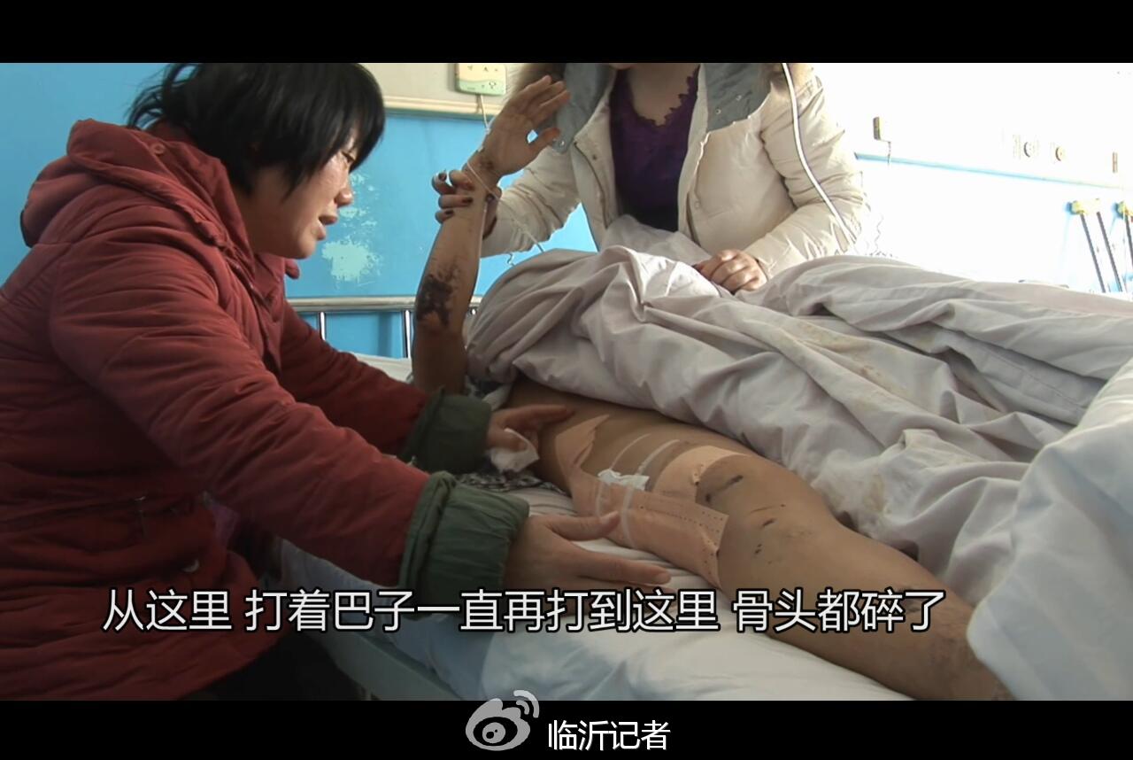 伤者母亲介绍伤情